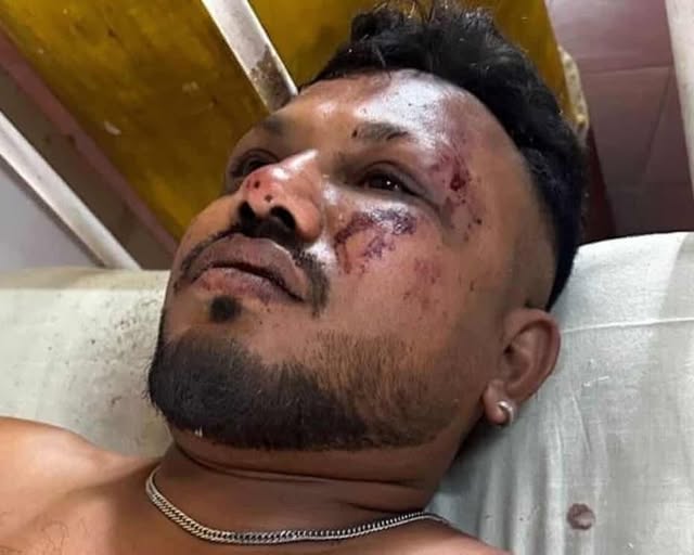 Un Britannique n&rsquo;a « aucune idée » de comment il a survécu au crash d&rsquo;Air India